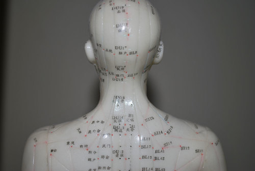 Vista posteriore del modello di agopuntura